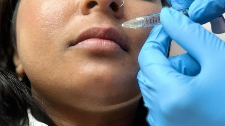 A precise MaClinica lip treatment in progress